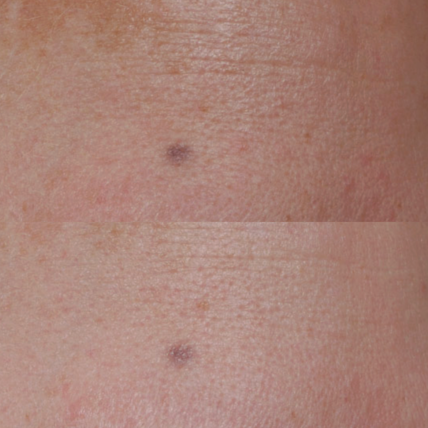 Epionce MelanoLyte Pigment Perfecting Serum
