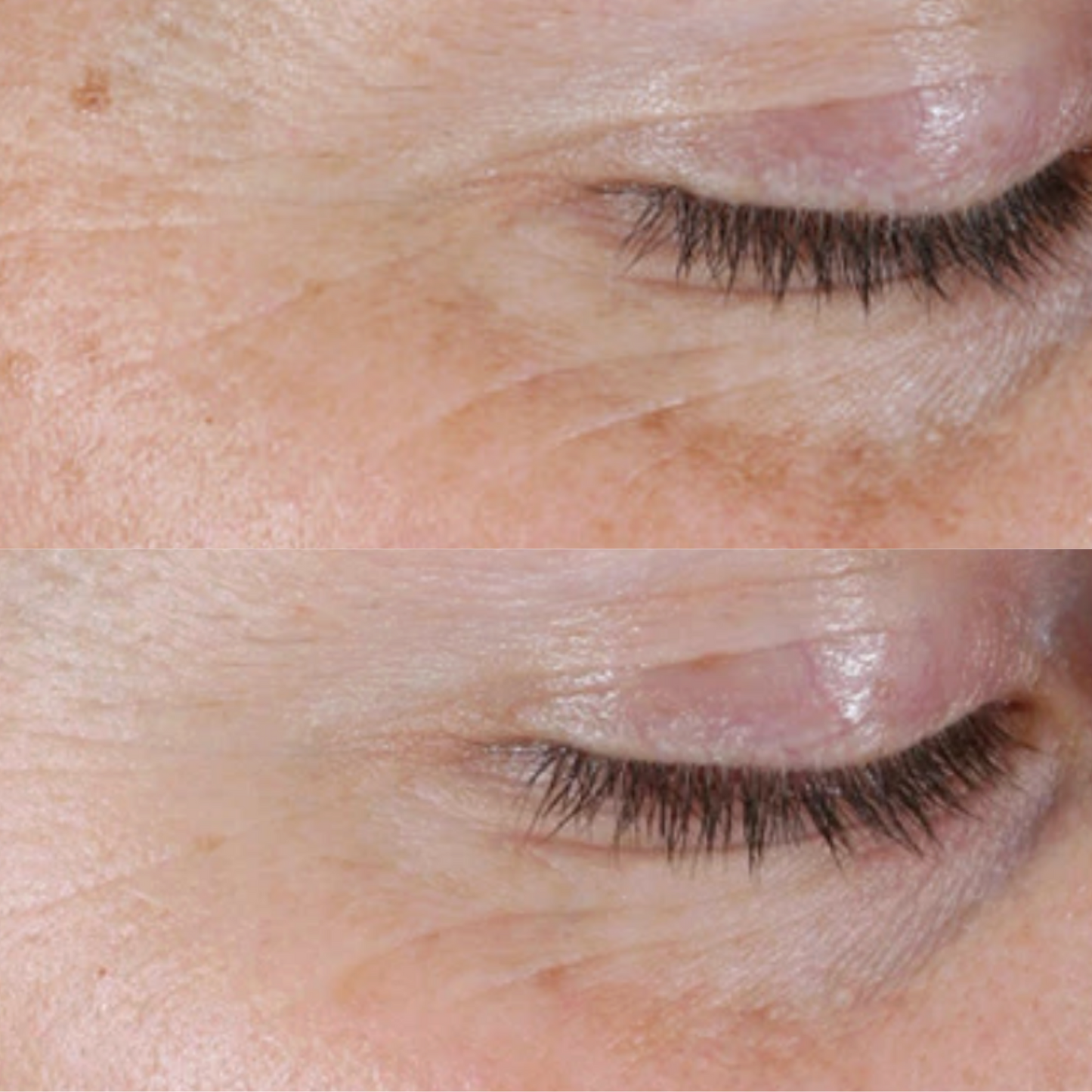 Alastin Renewal Retinol 0.25 | Beginner Retinol