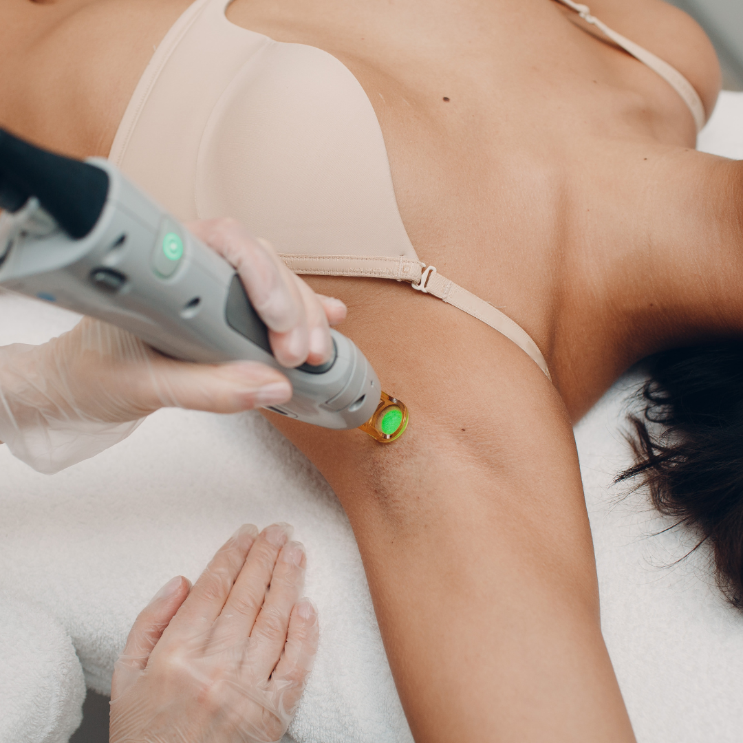 Laser Hair Removal (Small Area)