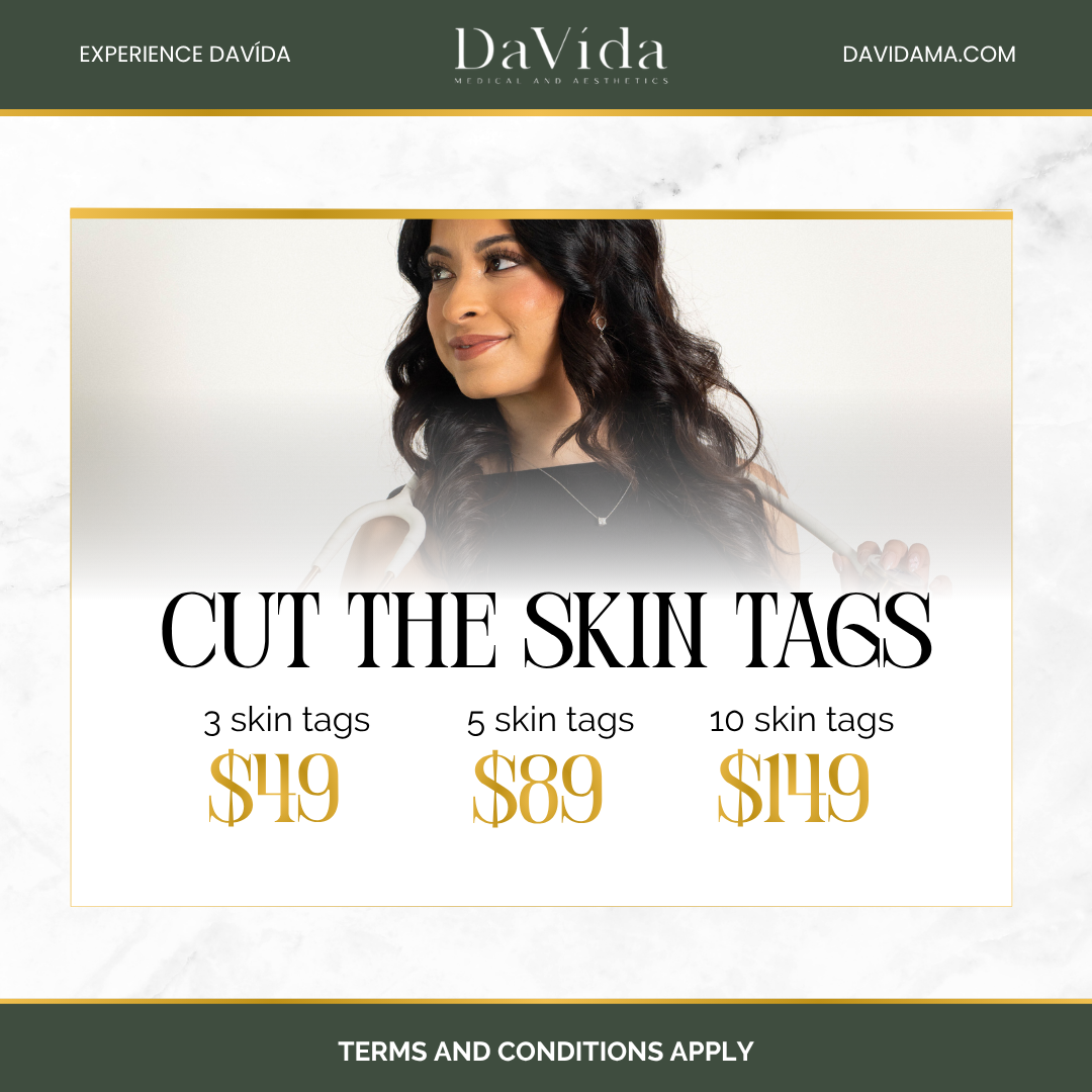 Cut The Skin Tags | Skin Tag Removal
