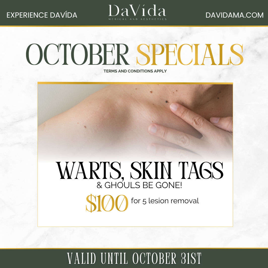 Warts, Skin Tags, & Ghouls Be Gone!