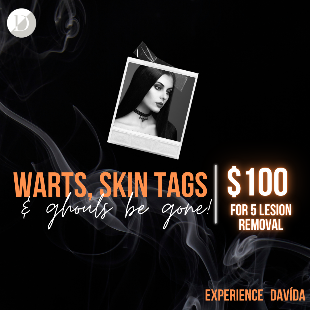 October Special - Warts, Skin Tags, and Ghouls be Gone!