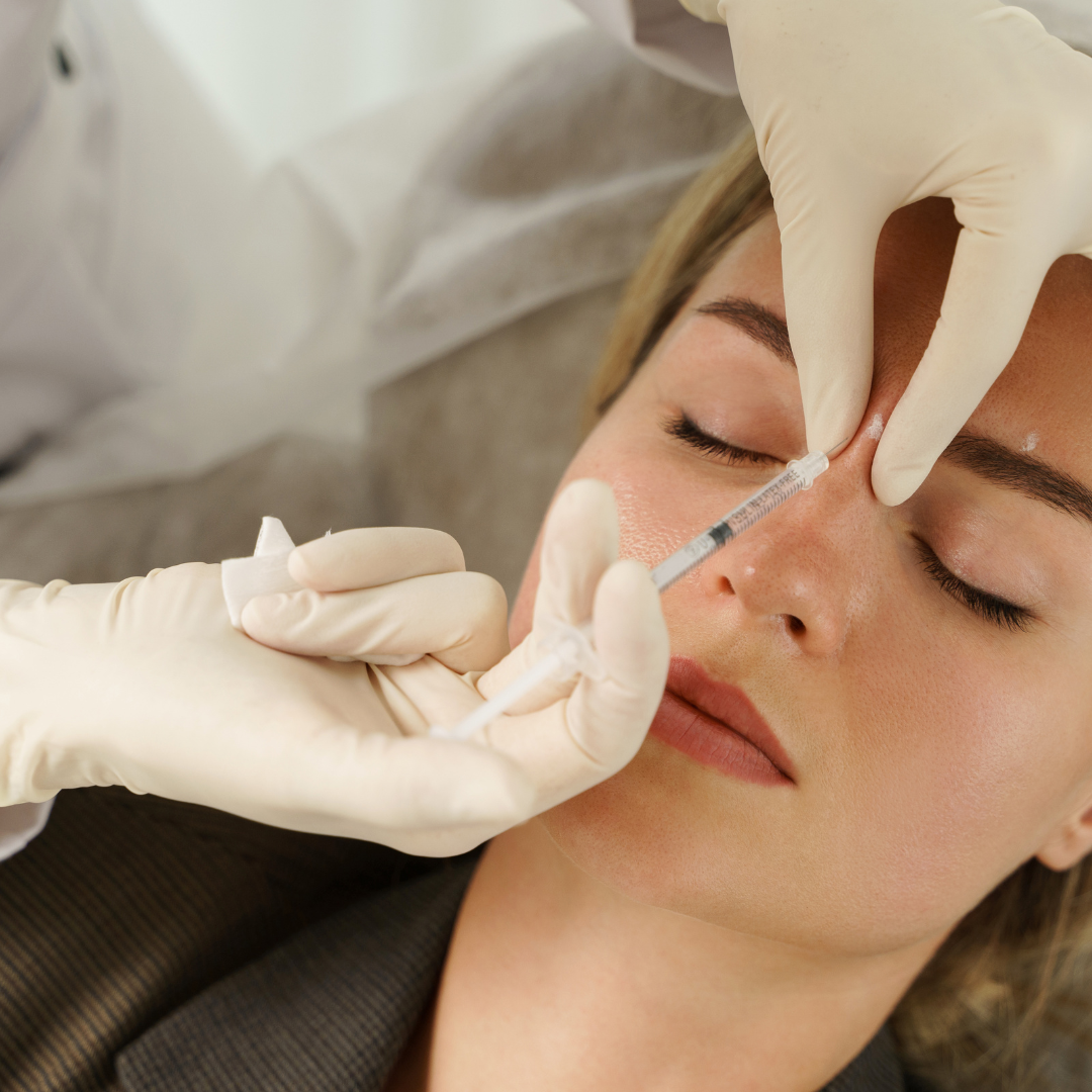 Juvederm Vollure XC (1 CC)