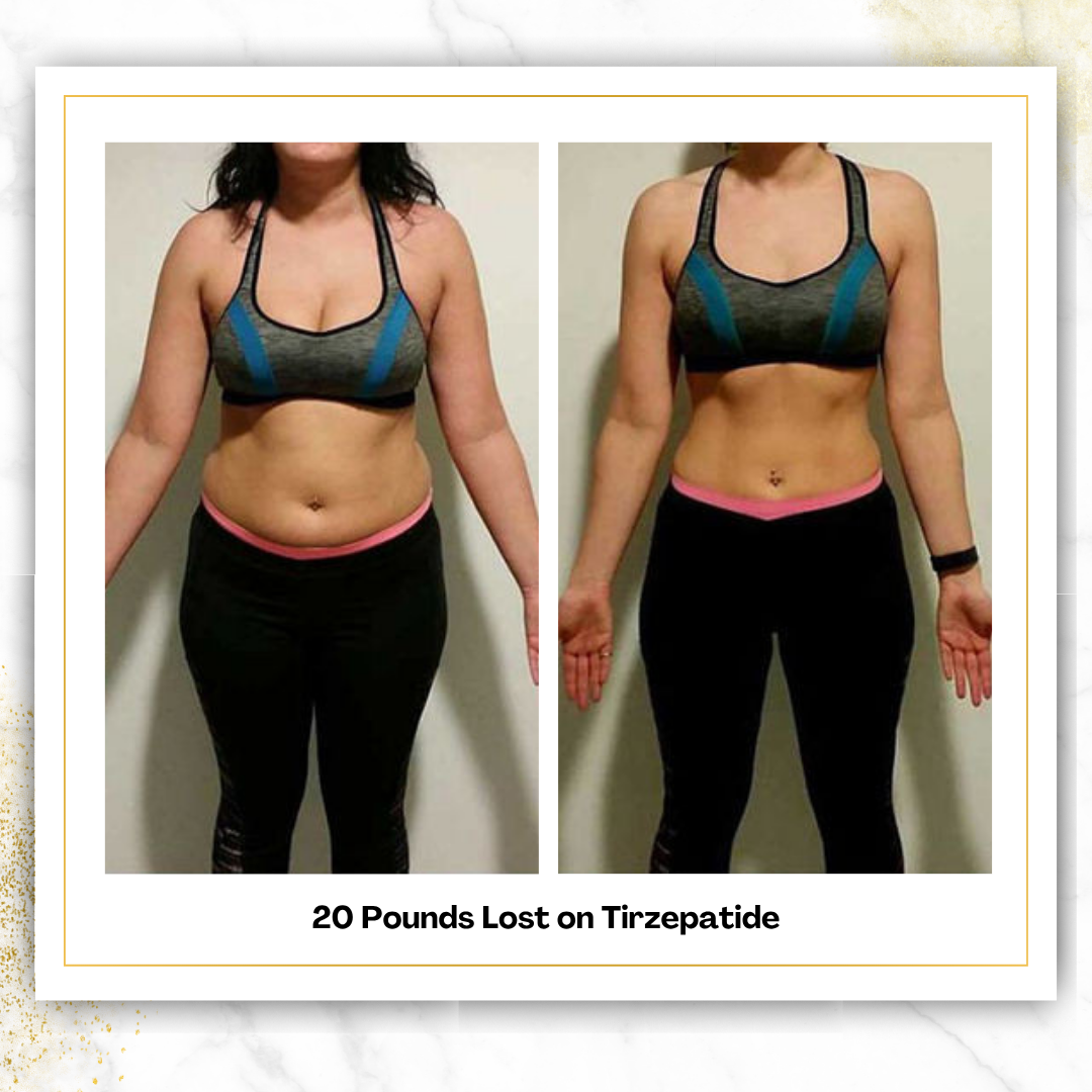 Tirzepatide (3-Month)