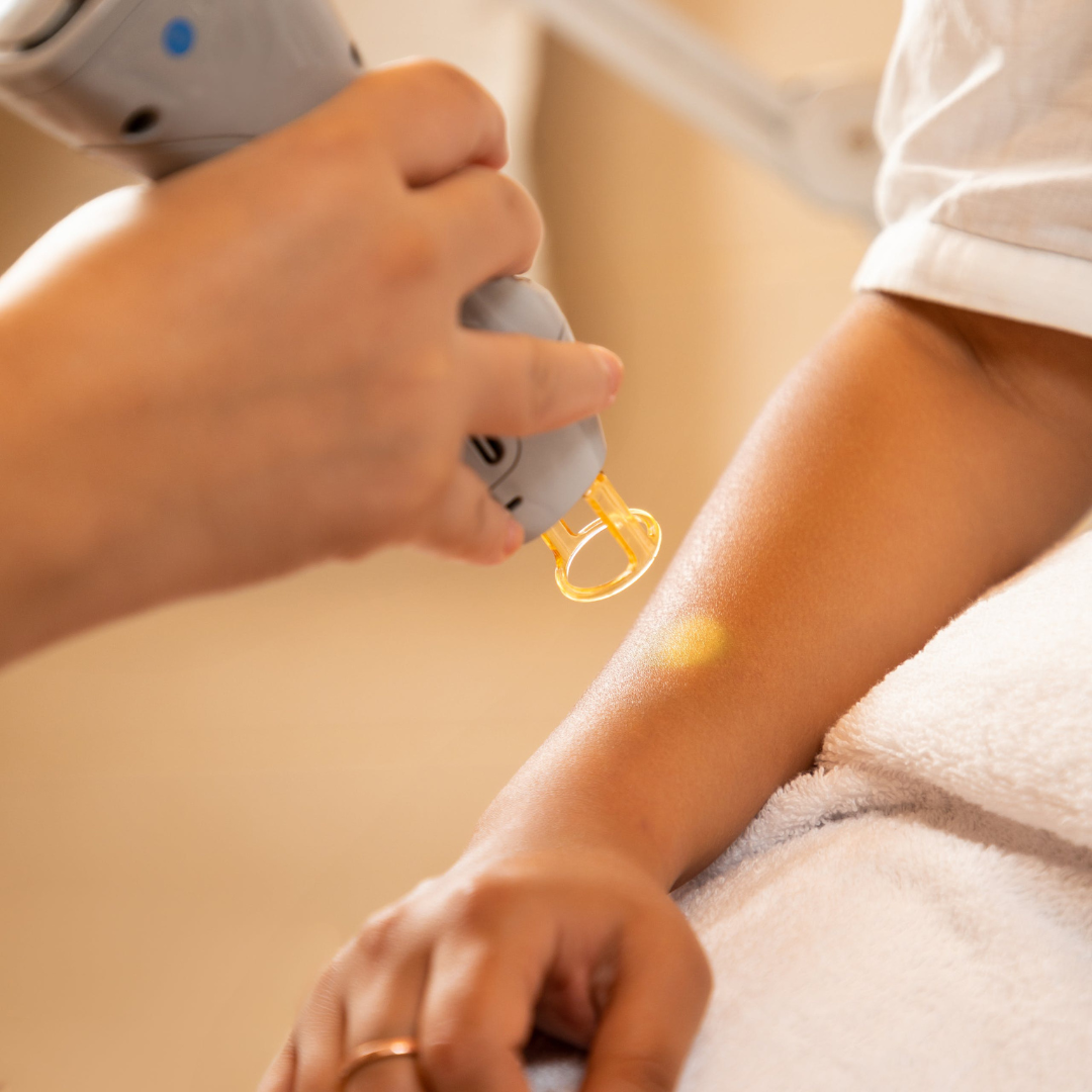 Laser Hair Removal (Medium Area)