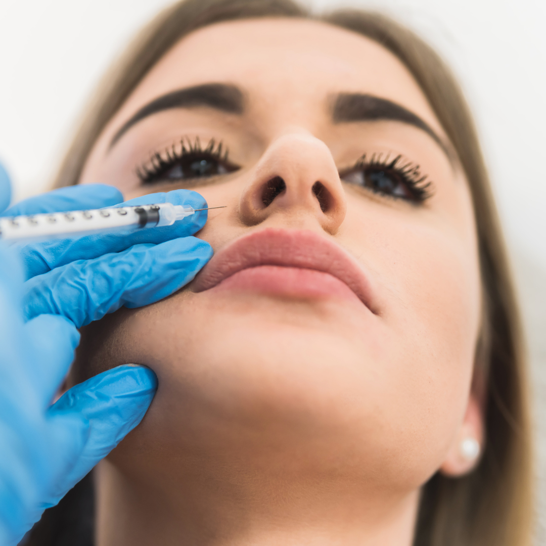 Restylane Refyne (1 CC)