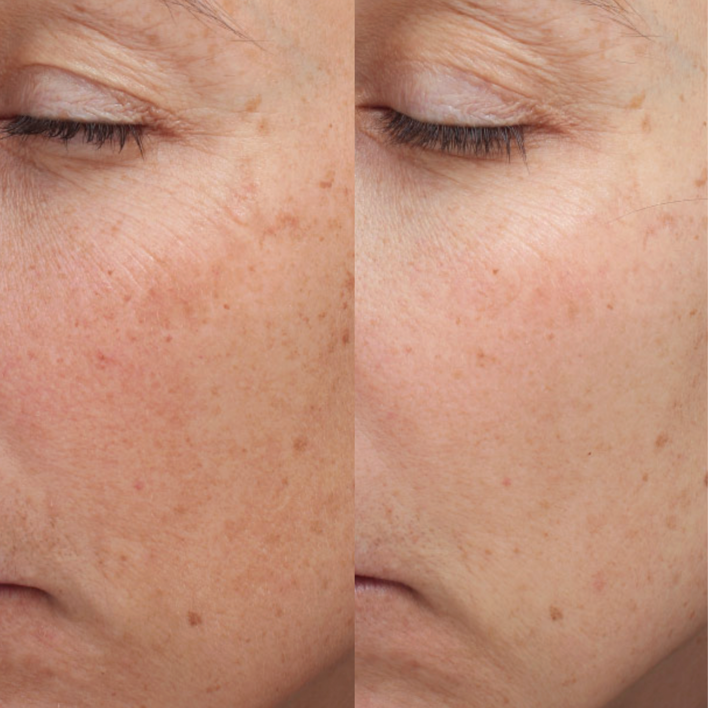 Epionce MelanoLyte Pigment Perfecting Serum