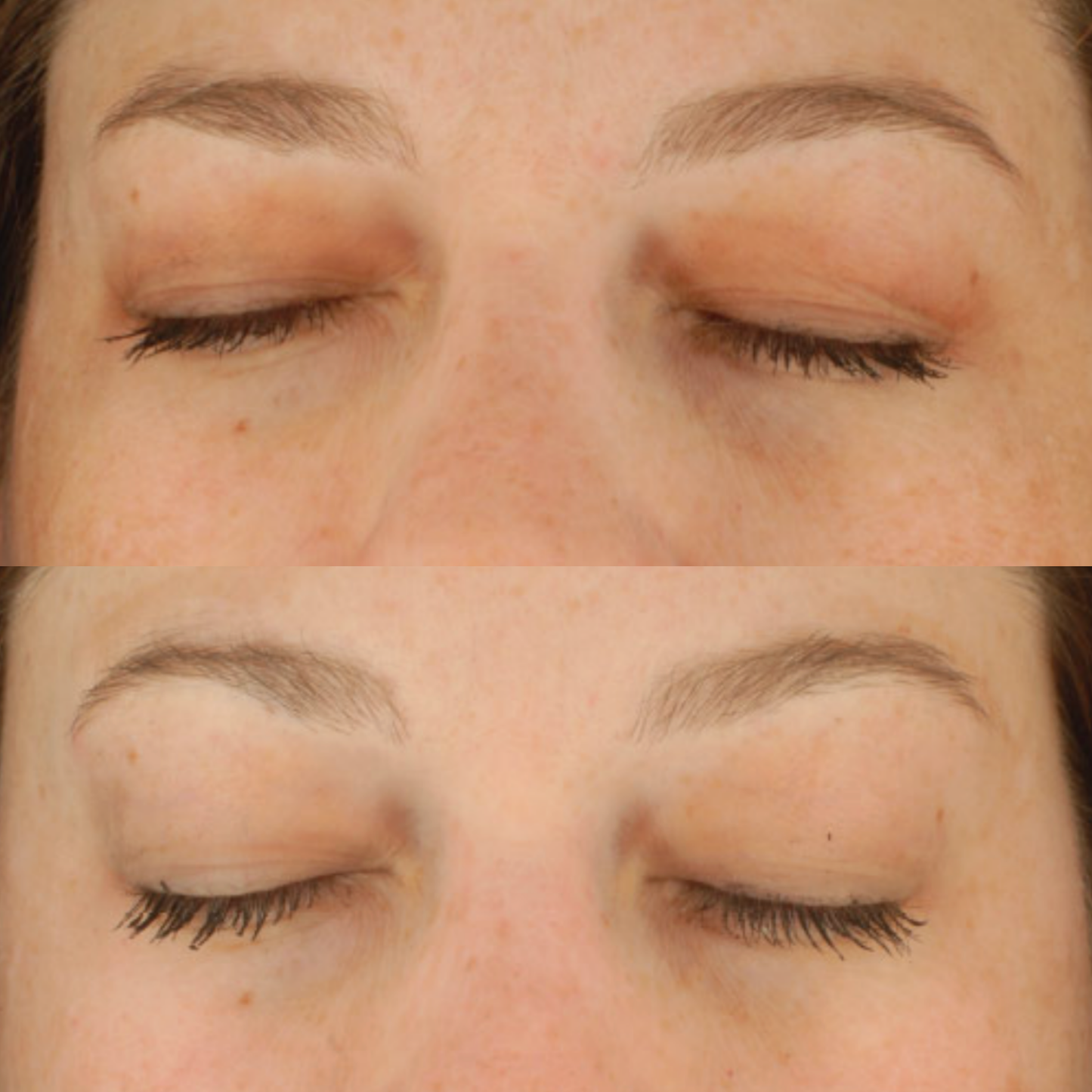 Epionce MelanoLyte Pigment Perfecting Serum