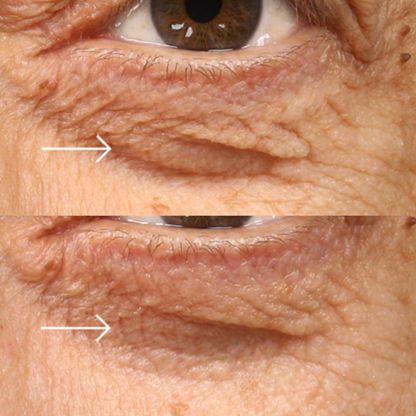 Epionce Luminous Eye Serum | Brightening Eye Serum
