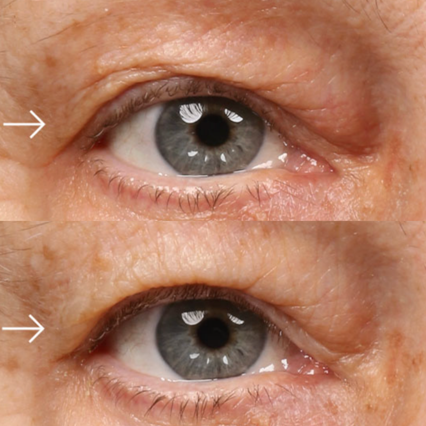 Epionce Luminous Eye Serum | Brightening Eye Serum