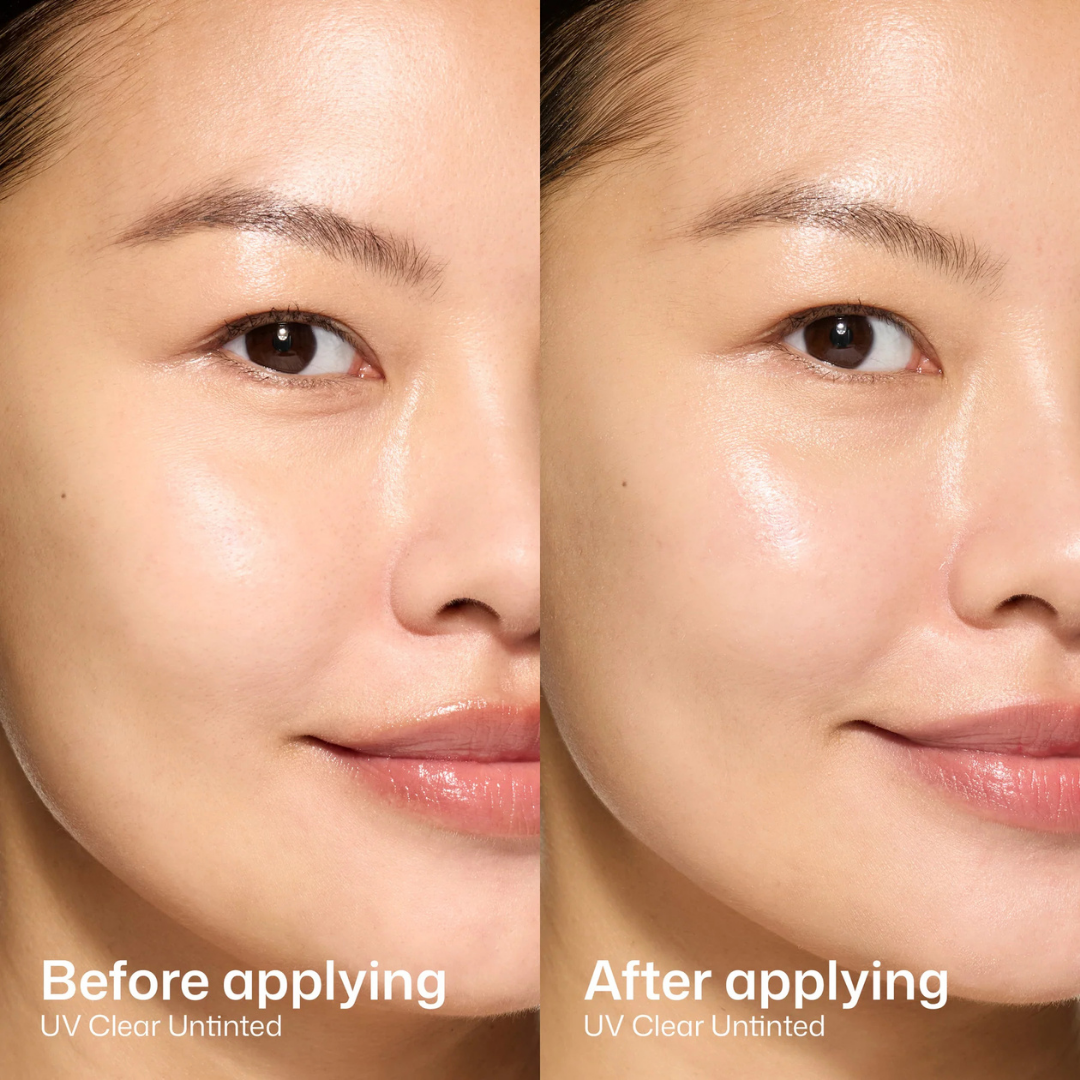 EltaMD UV Clear Sunscreen SPF 46 | Niacinamide