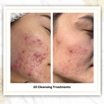 Cleansing Treatments