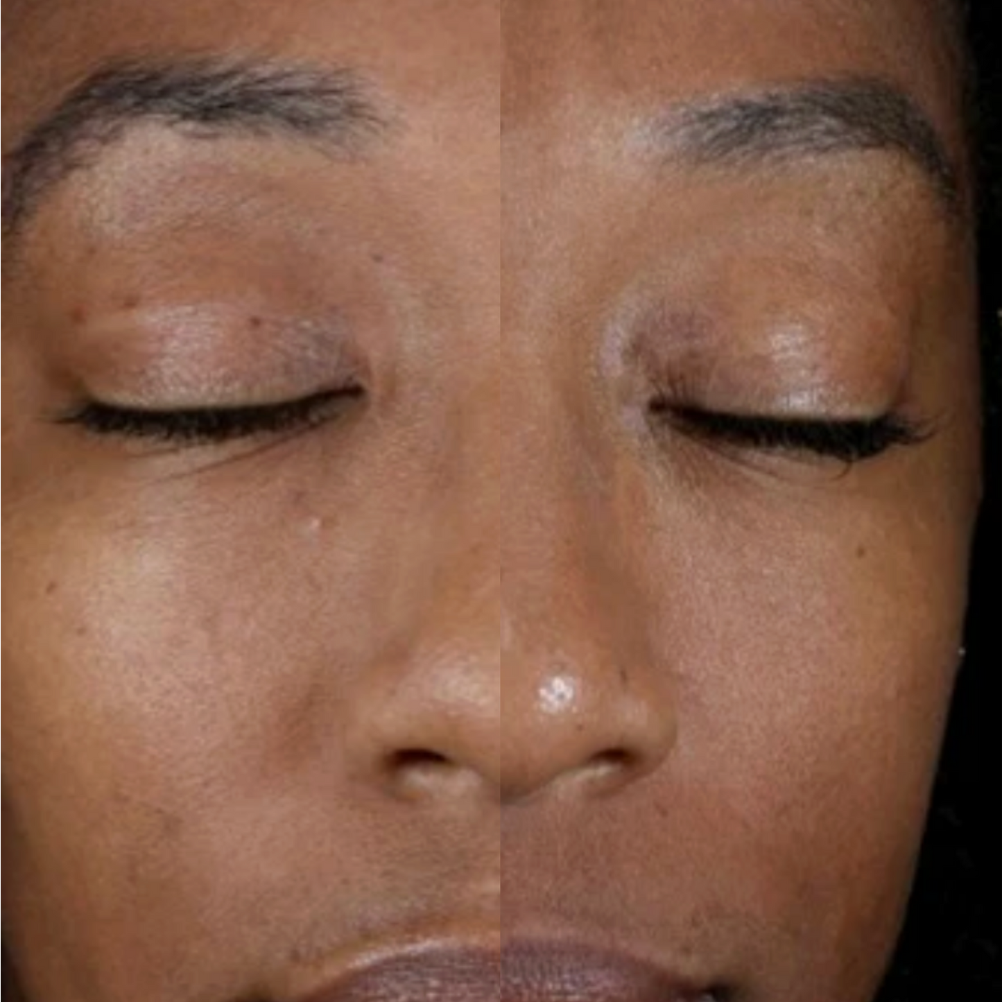 Alastin Renewal Retinol 0.25 | Beginner Retinol