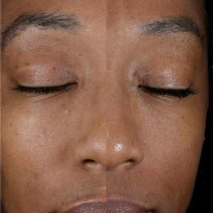 Alastin Renewal Retinol 0.25 | Beginner Retinol