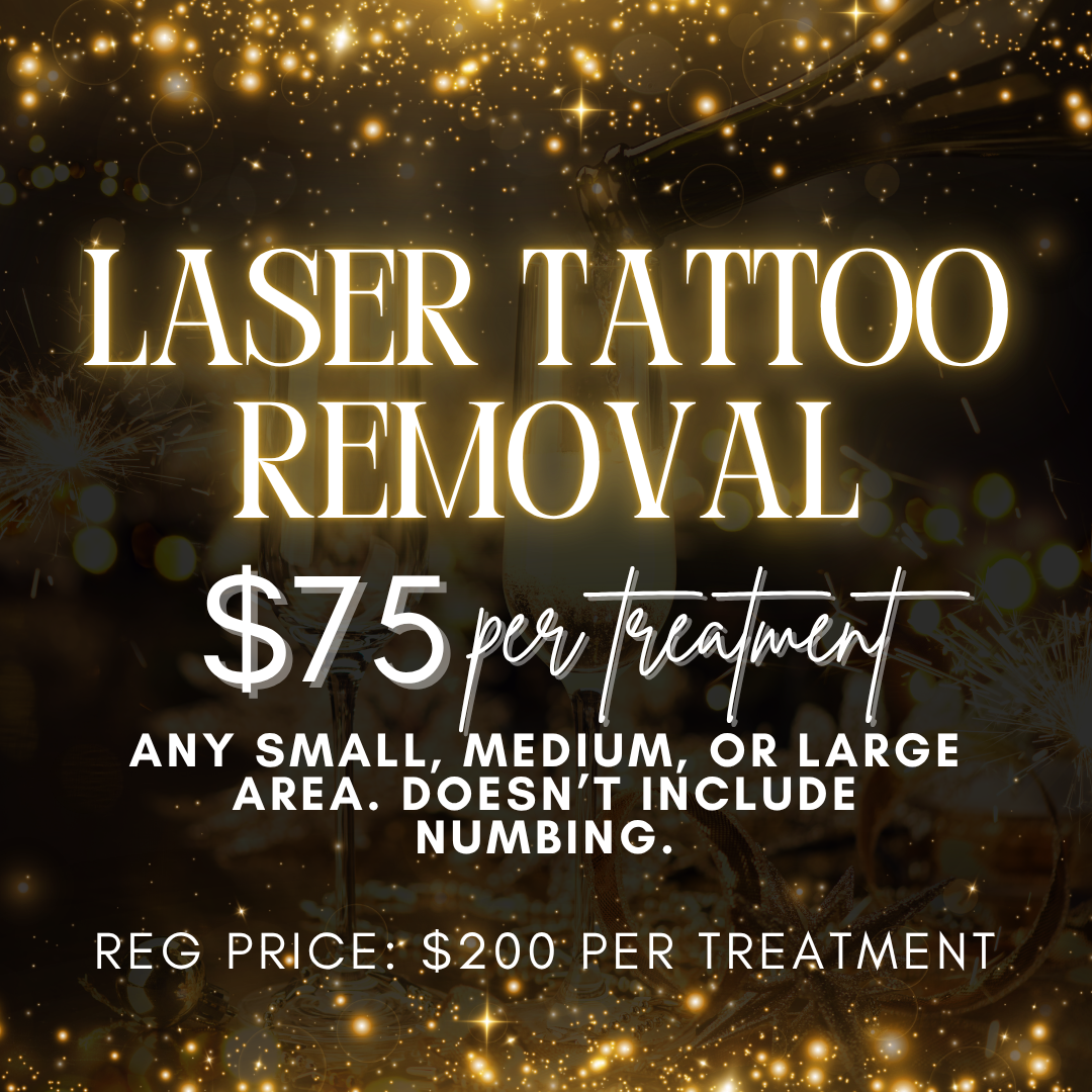 Tattoo Removal
