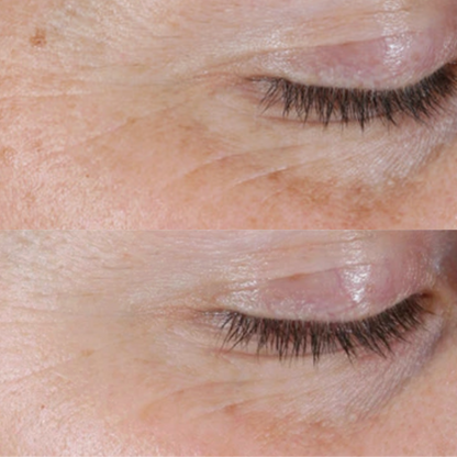 Alastin Renewal Retinol 0.25 | Beginner Retinol