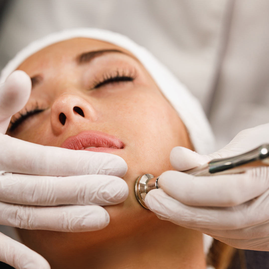 Microdermabrasion