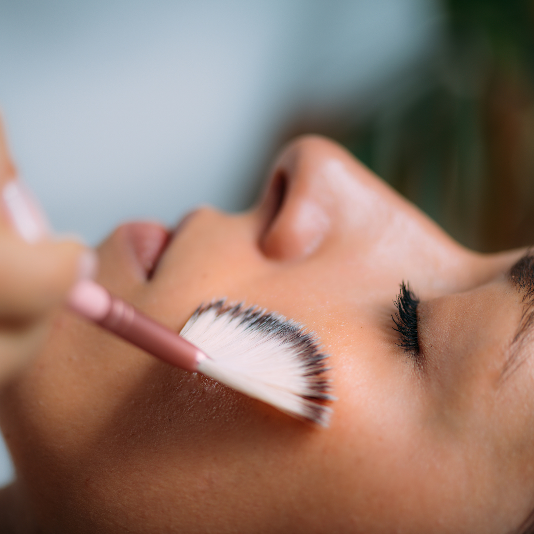 Light Chemical Peel