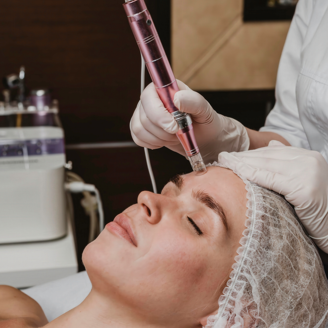 Microneedling | 2 for $450