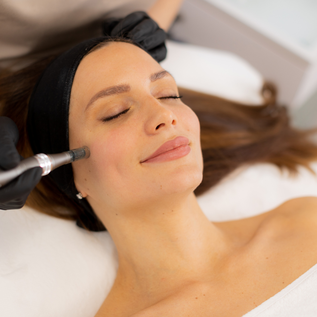 Microneedling With PDGF