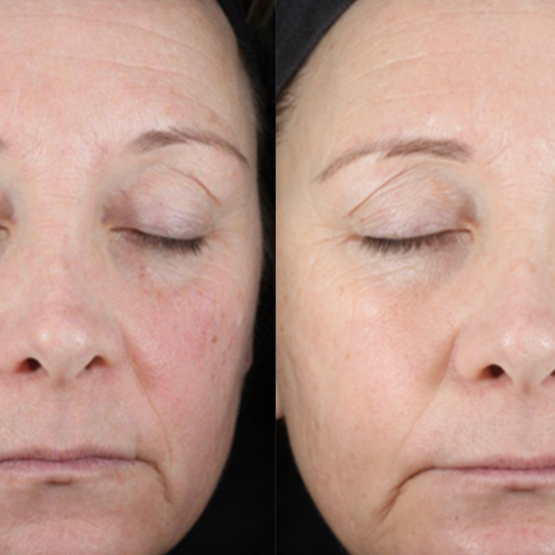 DaVida Skin HA Hydrating Serum | Hyaluronic Acid
