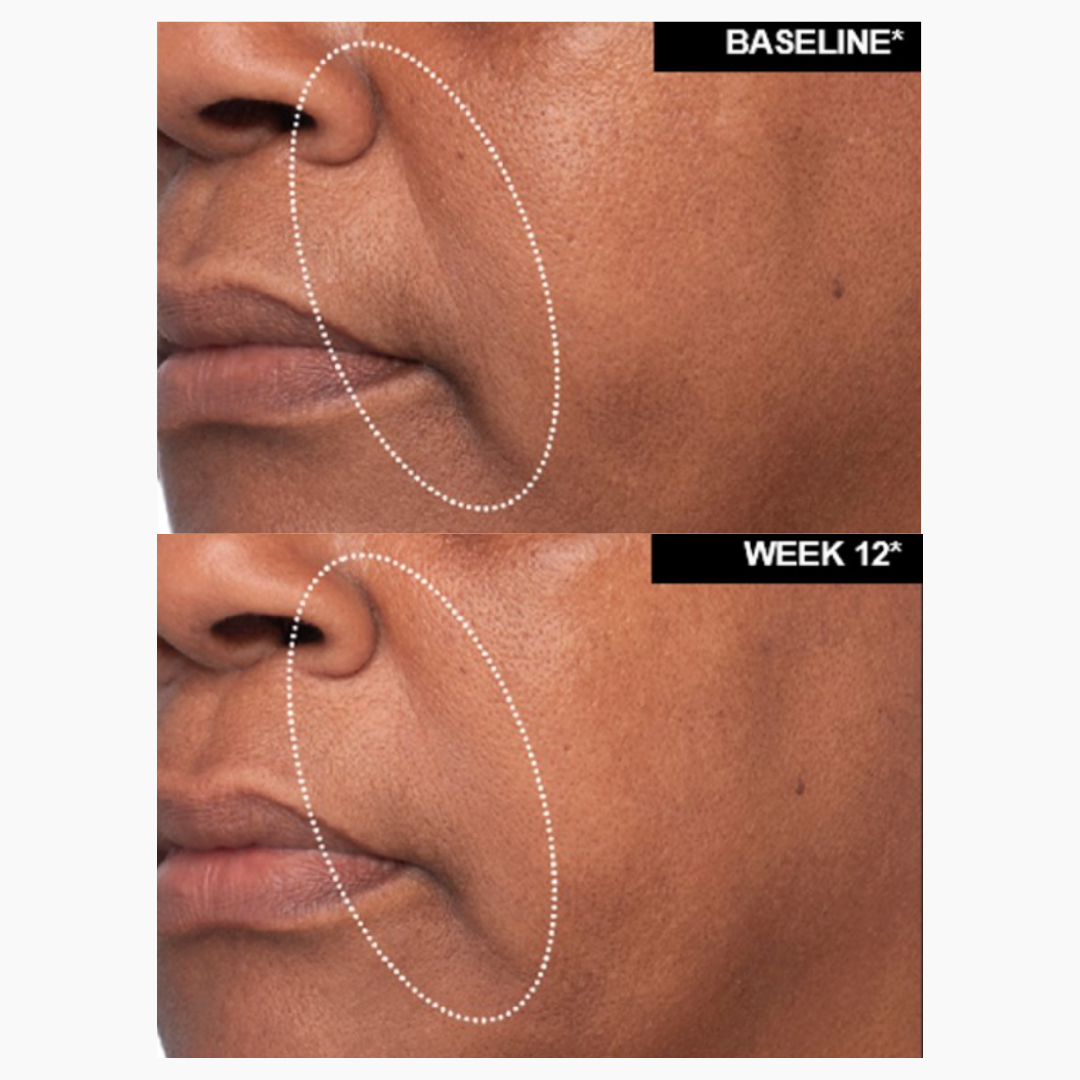 DaVida Skin Volume + Restoring Cream | Pro-Firm