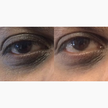 DaVida Skin Eye Boost | Retinol Eye Cream