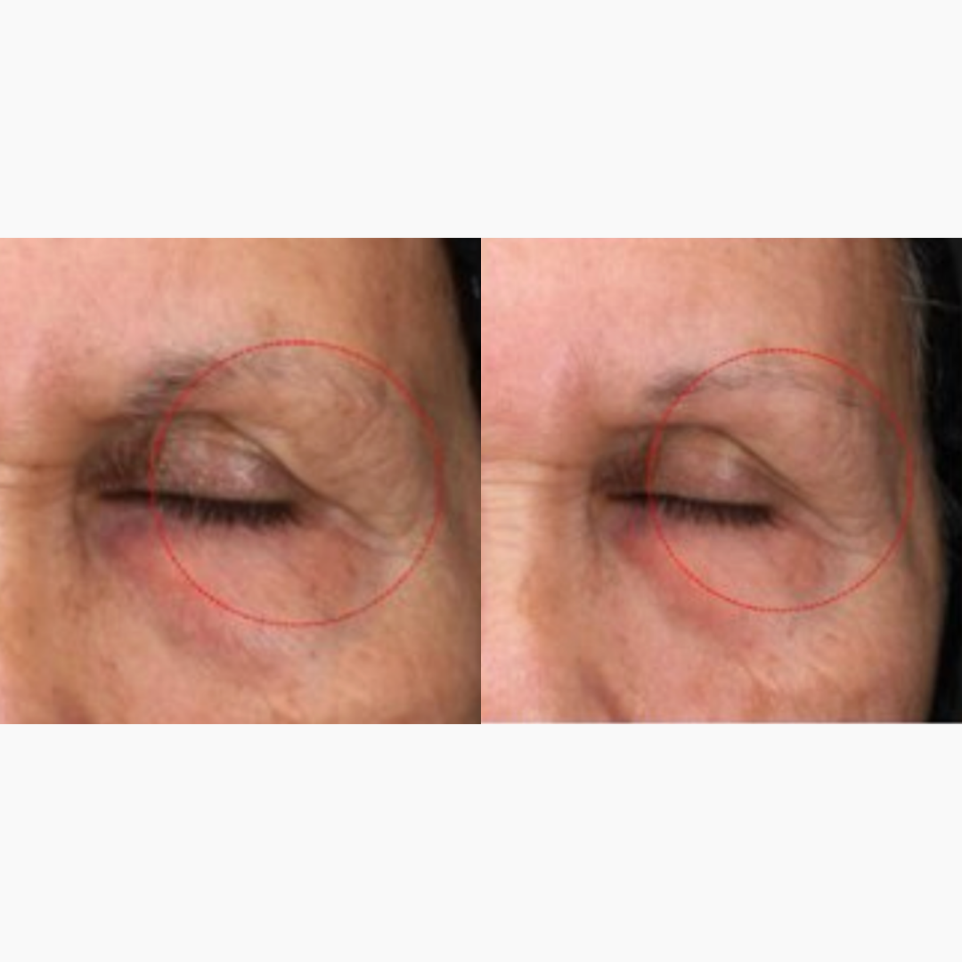 DaVida Skin - Perfection Eye Cream