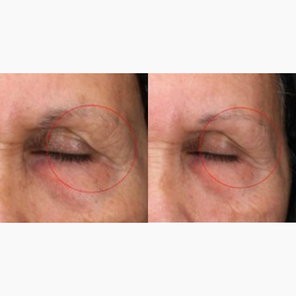 DaVida Skin - Perfection Eye Cream