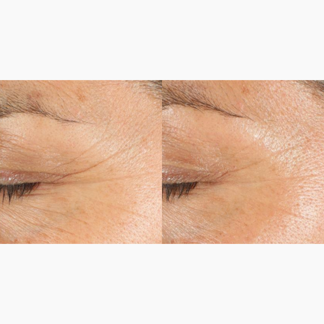 DaVida Skin - Perfection Cream