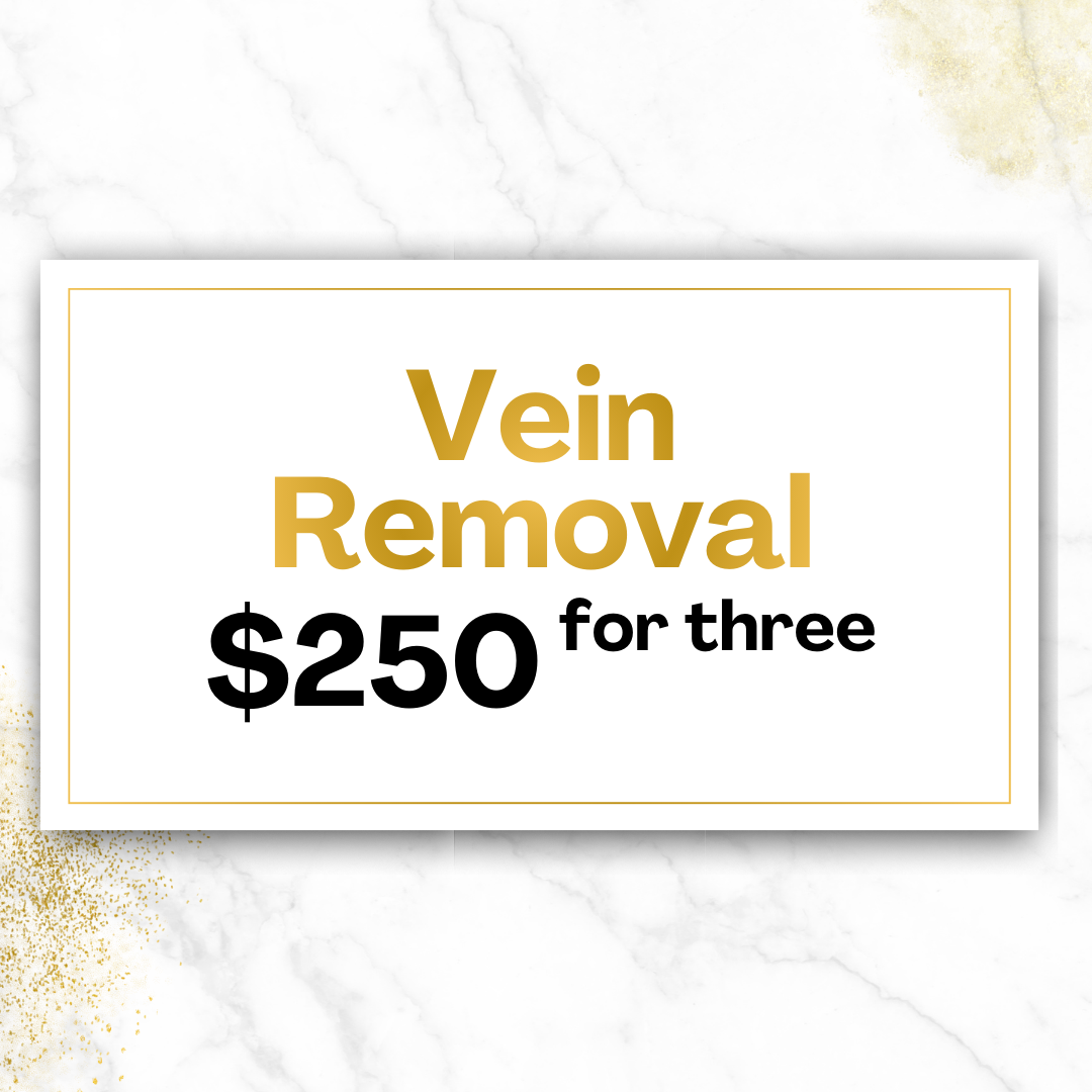 Laser Vein Removal