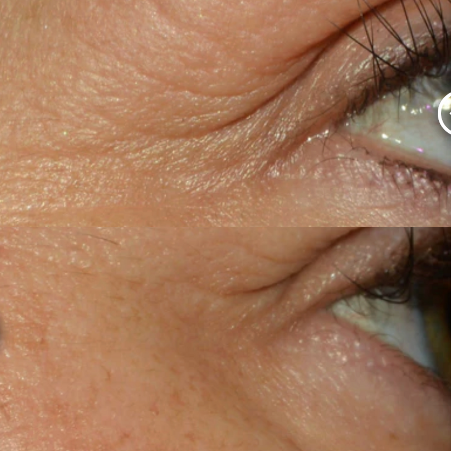 Alastin Restorative Eye Treatment