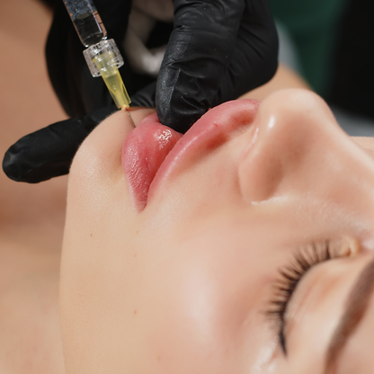 Juvederm Ultra+
