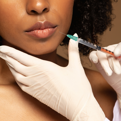 Juvederm Vollure