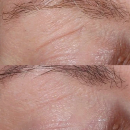 Alastin Restorative Eye Treatment
