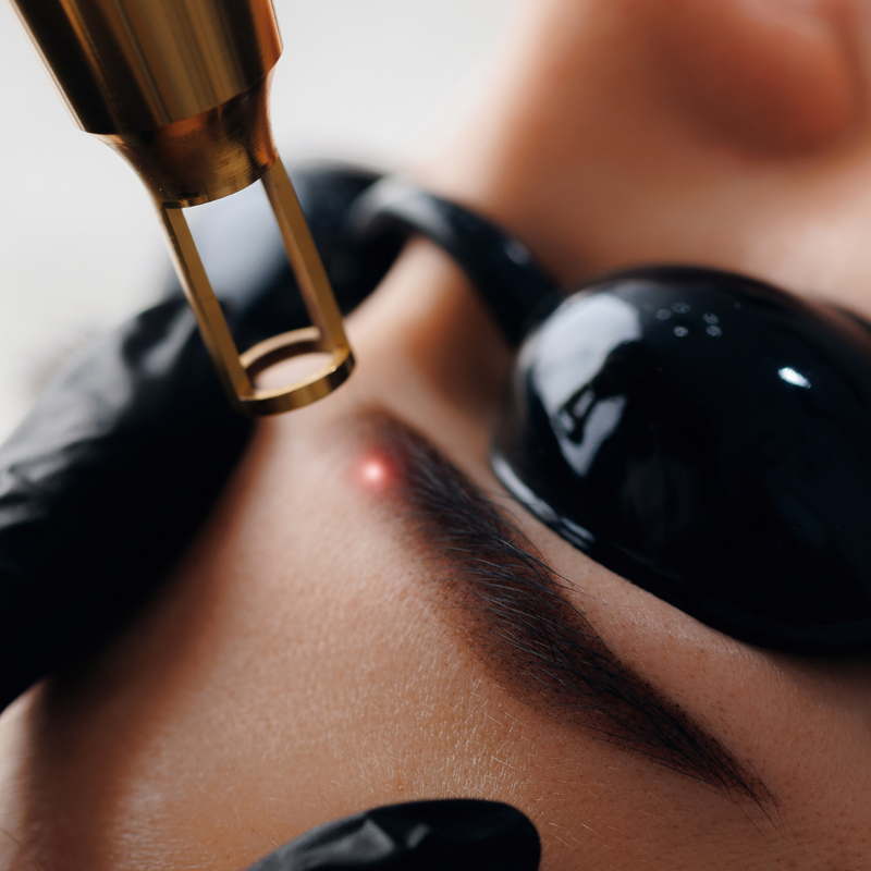 Erbium Skin Resurfacing