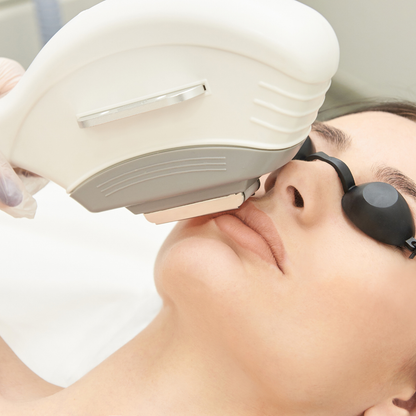 Laser Hair Removal (Small Area)
