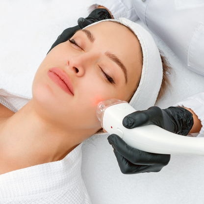 IPL (Brown Spot Removal) | 3 for $300