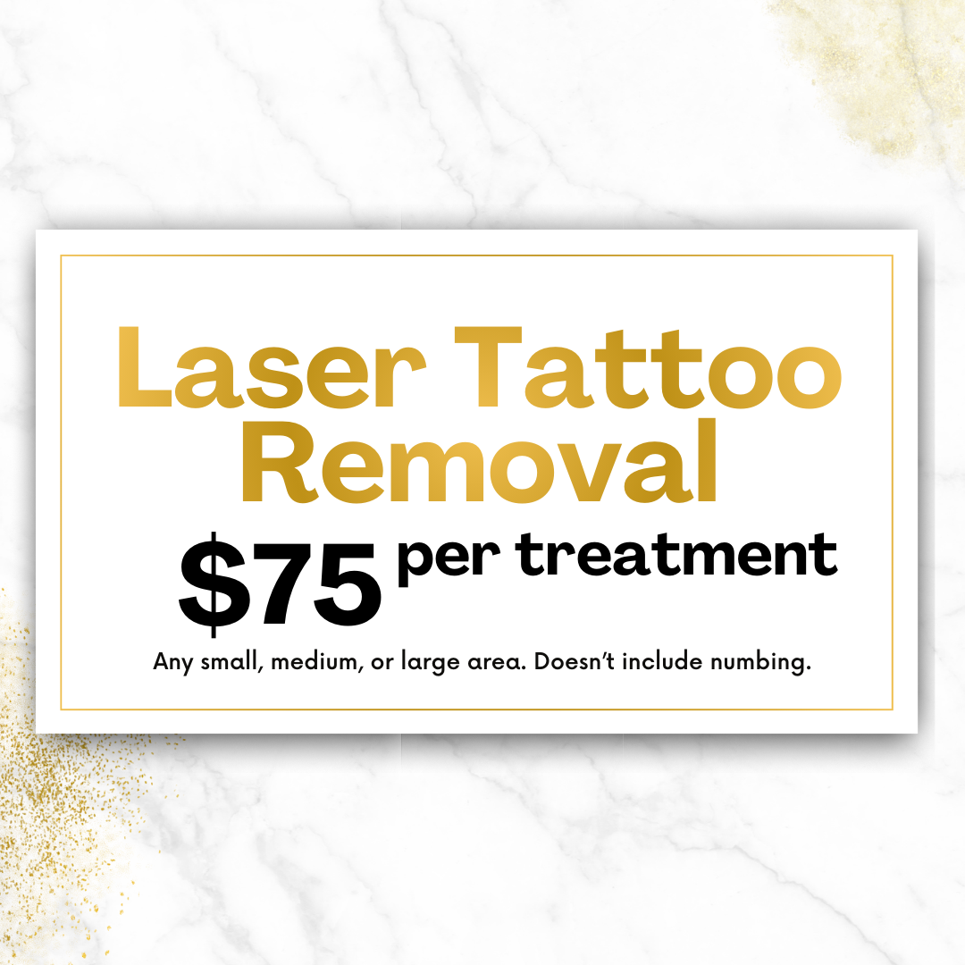 Laser Tattoo Removal