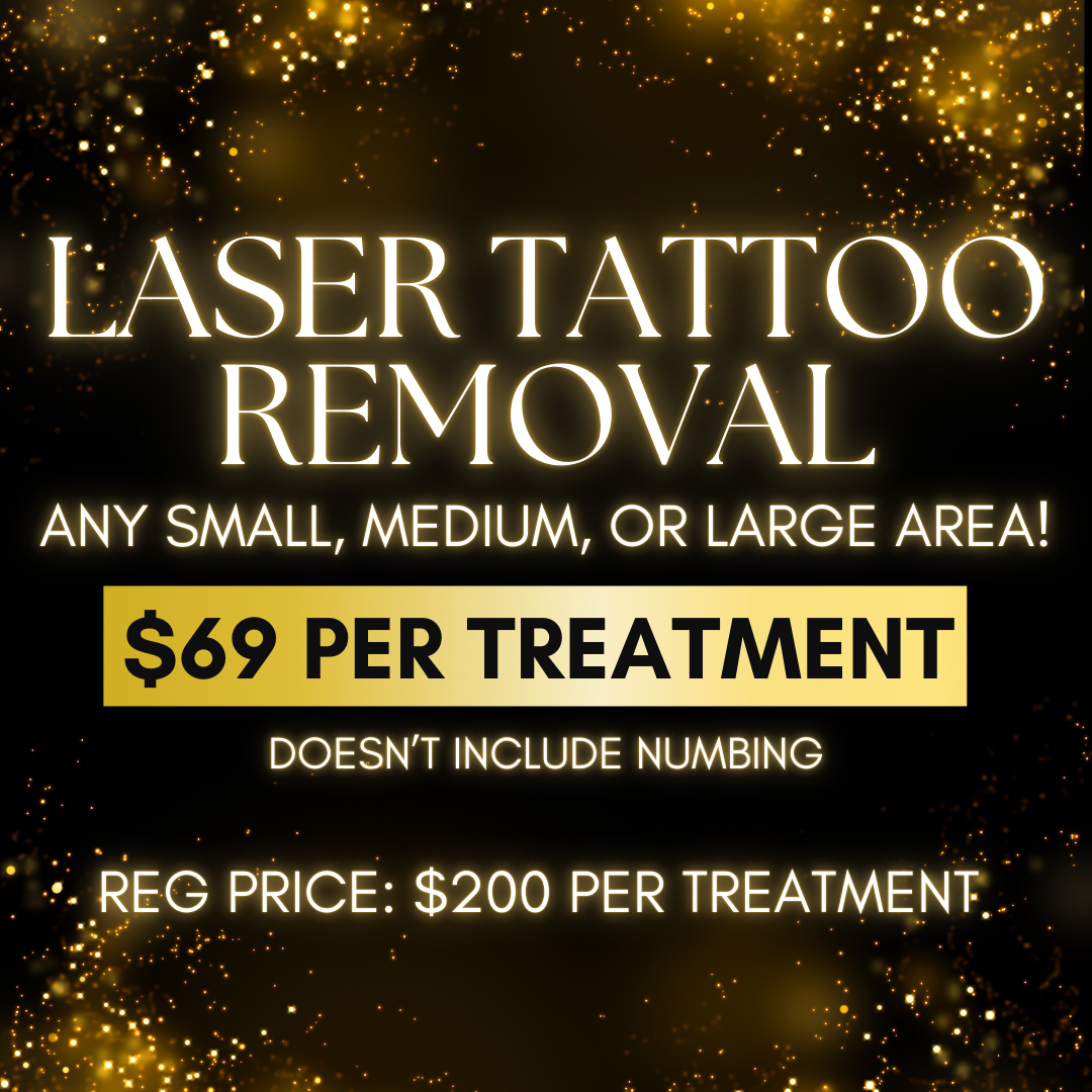 Laser Tattoo Removal