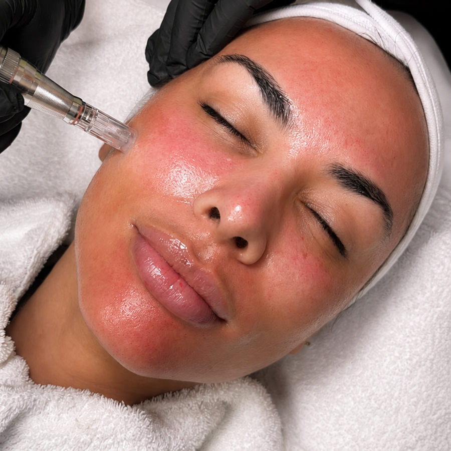Skin treatments