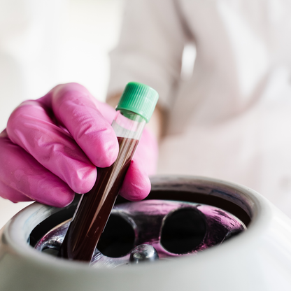 PRF Treatment in San Antonio | Natural Under-Eye | DaVida