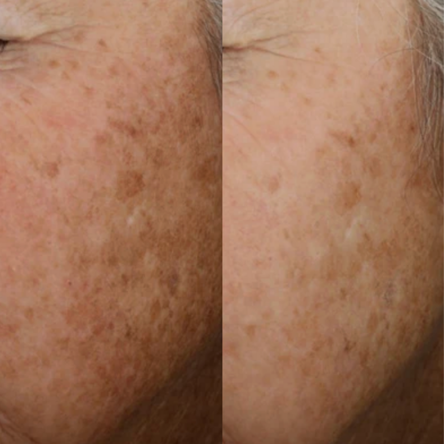 Alastin A-Luminate Brightening Serum