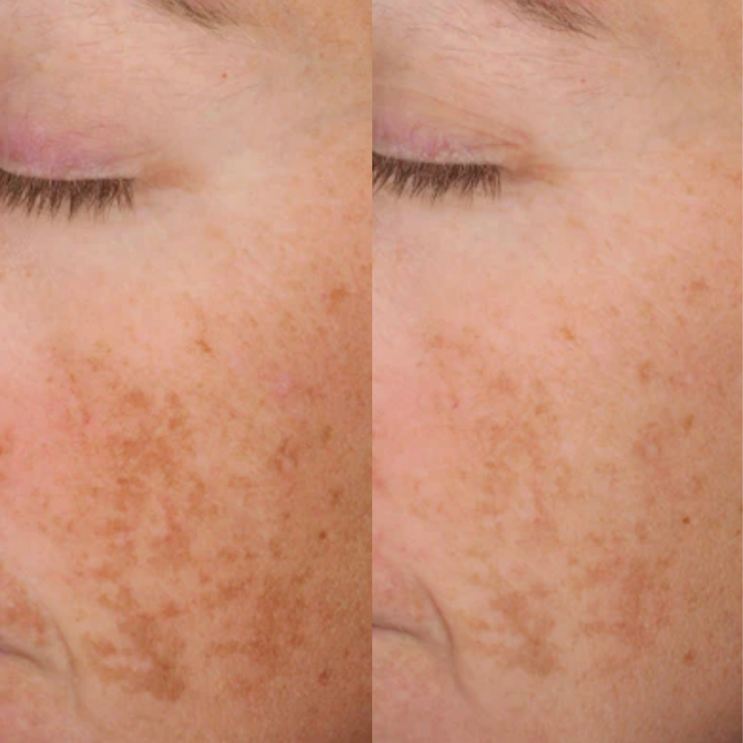Alastin A-Luminate Brightening Serum
