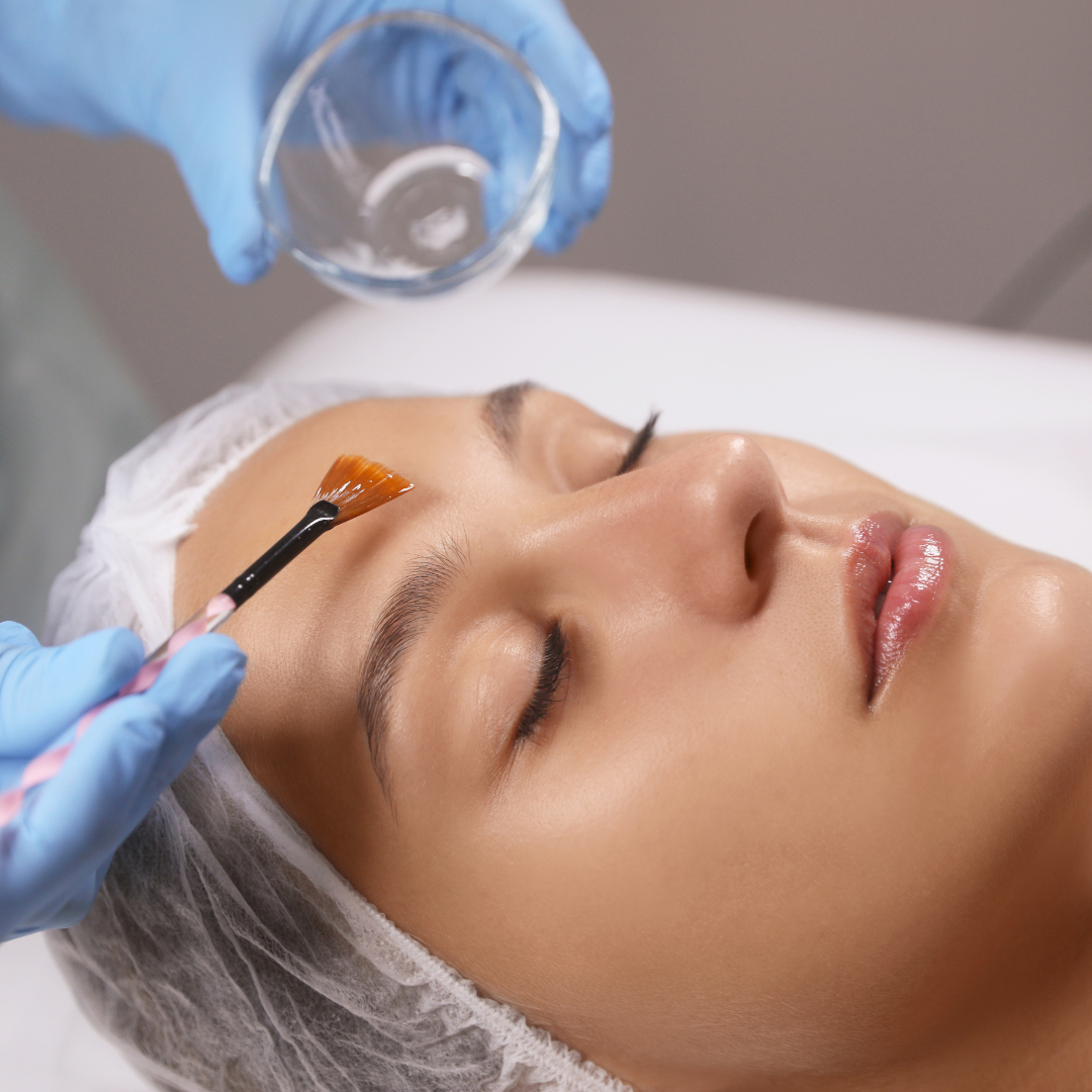 Signature Facelift Peel in San Antonio | $150 | DaVida