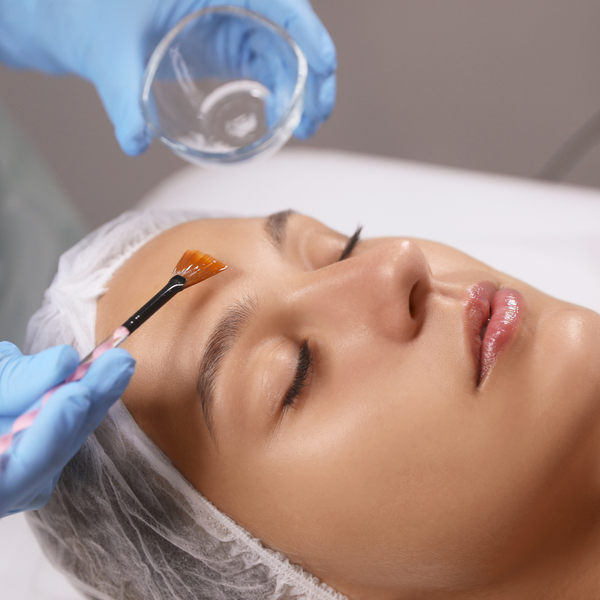 Signature Facelift Peel in San Antonio | $150 | DaVida