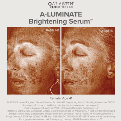 Alastin A-Luminate Brightening Serum Travel Size