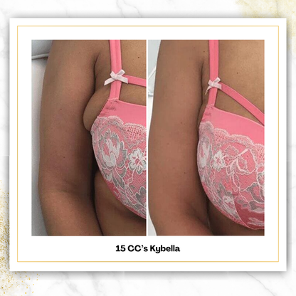 Kybella (Liquid Lipo) | 4 CC Unit Minimum