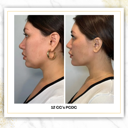 PCDC (Liquid Lipo) | 4 CC Unit Minimum