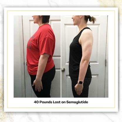 Semaglutide (Starter Pack)